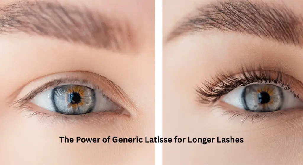 The Power of Generic Latisse for Longer Lashes